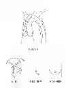 Fig. 38 - Aortic valve repair