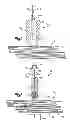 Fig. 03 - Robotic ultrasonic energy system