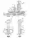 Fig. 08 - Robotic ultrasonic energy system