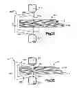 Fig. 11 - Robotic ultrasonic energy system