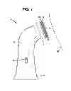 Fig. 02 - MECHANICAL SKIN RESURFACING
