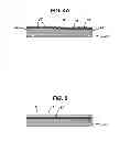 Fig. 05 - MECHANICAL SKIN RESURFACING