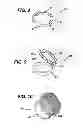Fig. 09 - MECHANICAL SKIN RESURFACING