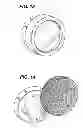 Fig. 11 - MECHANICAL SKIN RESURFACING