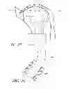 Fig. 05 - Suture passer systems and methods for palate suspension and compression