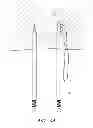 Fig. 09 - Suture passer systems and methods for palate suspension and compression