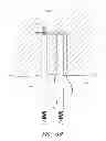 Fig. 12 - Suture passer systems and methods for palate suspension and compression