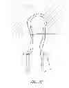 Fig. 13 - Suture passer systems and methods for palate suspension and compression