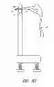 Fig. 16 - Suture passer systems and methods for palate suspension and compression