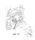 Fig. 20 - Suture passer systems and methods for palate suspension and compression