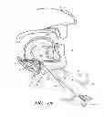 Fig. 23 - Suture passer systems and methods for palate suspension and compression