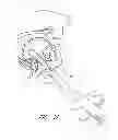 Fig. 24 - Suture passer systems and methods for palate suspension and compression