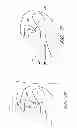 Fig. 30 - Suture passer systems and methods for palate suspension and compression