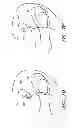 Fig. 31 - Suture passer systems and methods for palate suspension and compression