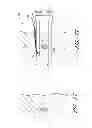 Fig. 32 - Suture passer systems and methods for palate suspension and compression