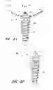 Fig. 35 - Suture passer systems and methods for palate suspension and compression