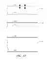 Fig. 39 - Suture passer systems and methods for palate suspension and compression