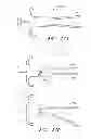 Fig. 40 - Suture passer systems and methods for palate suspension and compression