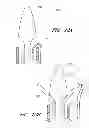 Fig. 41 - Suture passer systems and methods for palate suspension and compression