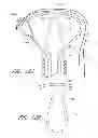 Fig. 42 - Suture passer systems and methods for palate suspension and compression