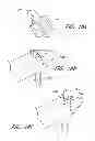 Fig. 47 - Suture passer systems and methods for palate suspension and compression
