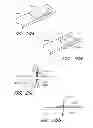 Fig. 49 - Suture passer systems and methods for palate suspension and compression