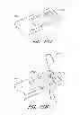Fig. 50 - Suture passer systems and methods for palate suspension and compression