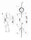 Fig. 53 - Suture passer systems and methods for palate suspension and compression