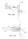 Fig. 55 - Suture passer systems and methods for palate suspension and compression