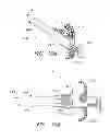 Fig. 56 - Suture passer systems and methods for palate suspension and compression