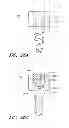 Fig. 58 - Suture passer systems and methods for palate suspension and compression