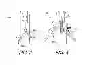 Fig. 03 - Suturing instrument for passing multiple sutures