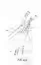 Fig. 04 - Suturing instrument for passing multiple sutures