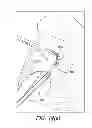 Fig. 13 - Suturing instrument for passing multiple sutures