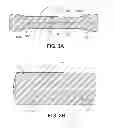 Fig. 03 - SUTURE PULLER