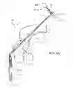 Fig. 05 - SUTURE PULLER