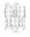 Fig. 06 - Prosthesis comprising a three-dimensional and openworked knit