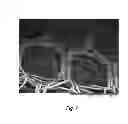 Fig. 07 - Prosthesis comprising a three-dimensional and openworked knit