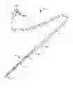 Fig. 01 - Method and system for treating valve stenosis