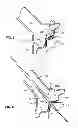 Fig. 05 - Method and system for treating valve stenosis