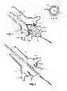 Fig. 06 - Method and system for treating valve stenosis