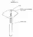 Fig. 02 - Infection control scalpel