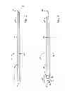 Fig. 04 - Method of creating a shear stress field with medical device
