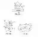 Fig. 08 - METHODS AND DEVICES FOR DEPLOYING AND RELEASING A TEMPORARY IMPLANT WITHIN THE BODY