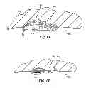 Fig. 12 - METHODS AND DEVICES FOR DEPLOYING AND RELEASING A TEMPORARY IMPLANT WITHIN THE BODY