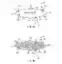 Fig. 13 - METHODS AND DEVICES FOR DEPLOYING AND RELEASING A TEMPORARY IMPLANT WITHIN THE BODY