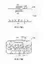 Fig. 14 - METHODS AND DEVICES FOR DEPLOYING AND RELEASING A TEMPORARY IMPLANT WITHIN THE BODY