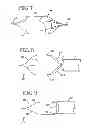 Fig. 04 - Removable lung reduction devices, systems, and methods