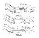 Fig. 05 - Removable lung reduction devices, systems, and methods