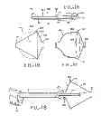 Fig. 07 - Removable lung reduction devices, systems, and methods